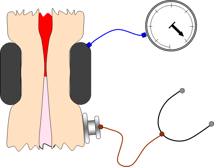Comment prendre sa tension artérielle avec un tensiomètre brassard ? - SMSP