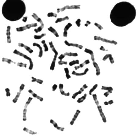 Caryotype_f_nonclass.JPG (34002 octets)