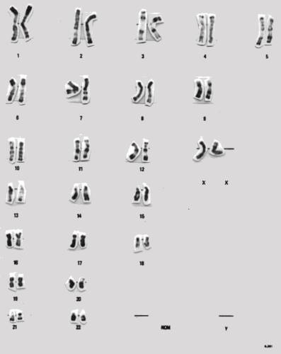 caryotype_f_class.JPG (51569 octets)