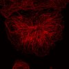 Détection de microtubules à l'aide d'anticorps fluorescents dans des (...)