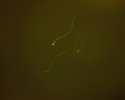 Steinernema carpocapsae et symbiotes bactériens (microscope à fluorescence) (...)