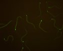 Steinernema carpocapsae et symbiotes bactériens (microscope à fluorescence) (...)