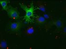 Protéines fluorescentes membranaires (en vert et rouge) et noyaux (marqués (...)